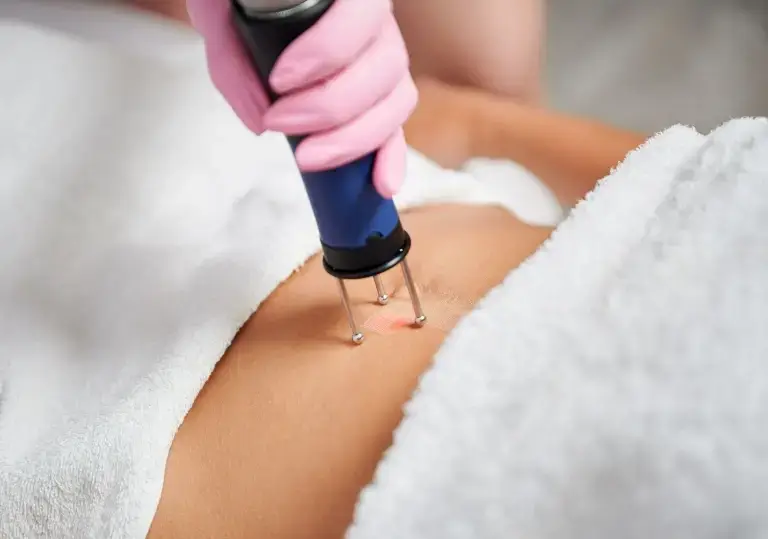 frakcyjny ablacyjny laser