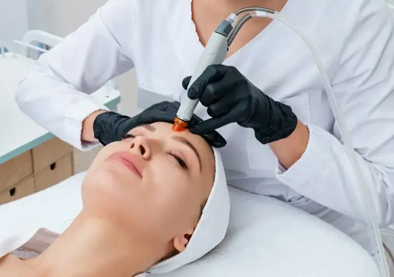 mikroigłowa mezoterapia